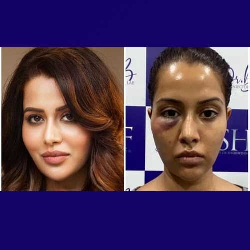 Actress Raiza Welson seeks ₹1cr from dermatologist